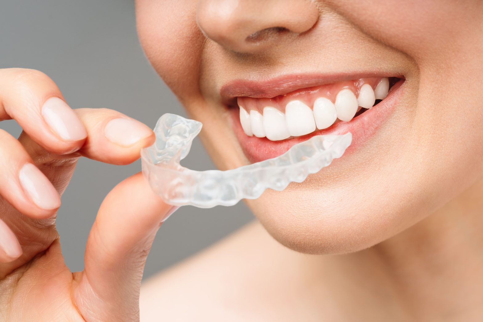 5 Reasons to Choose Invisalign for Your Smile