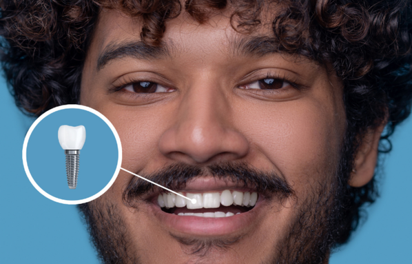 Dental Implant Treatment