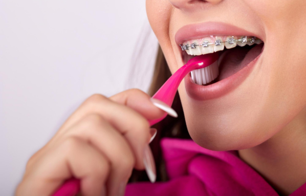 Oral Hygiene