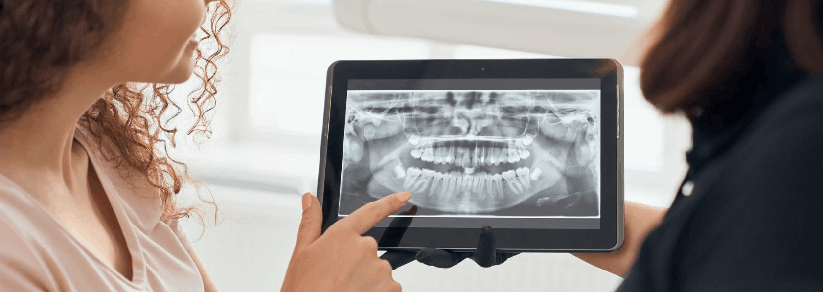 Dental implant Treatment