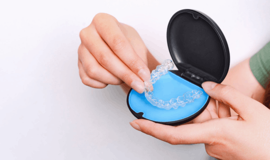 Invisalign Aligners